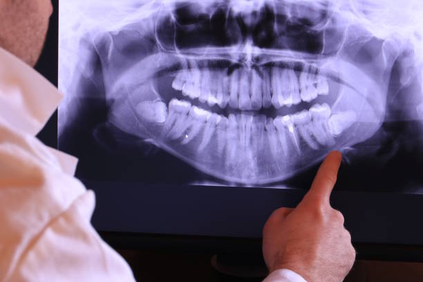 Best Cracked Tooth Emergency Dentist  in St Anthony, MN