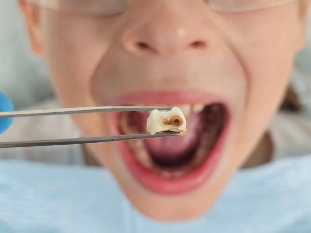 Best Emergency Gum Pain Relief  in St Anthony, MN